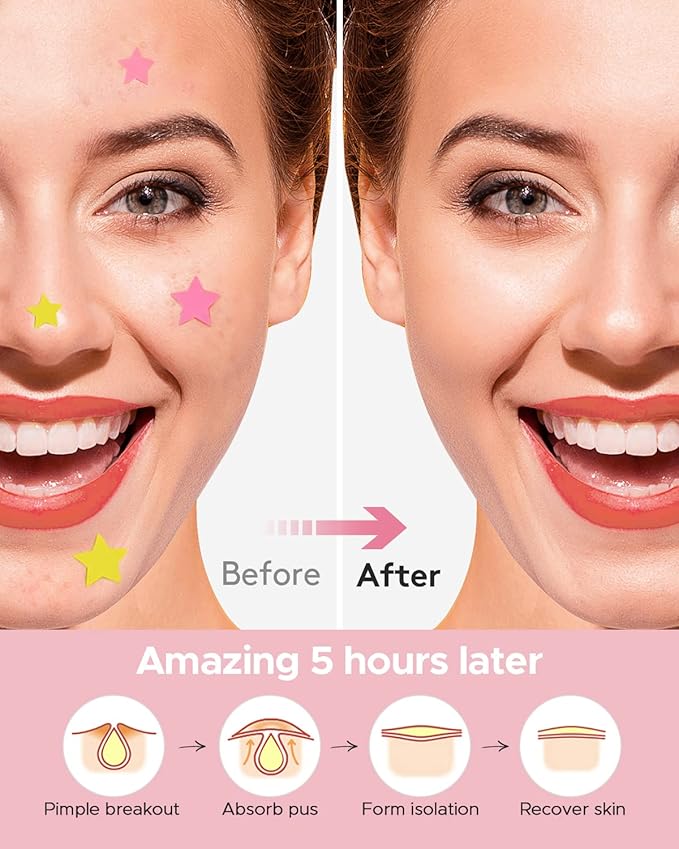 Acne Care Heart Patches