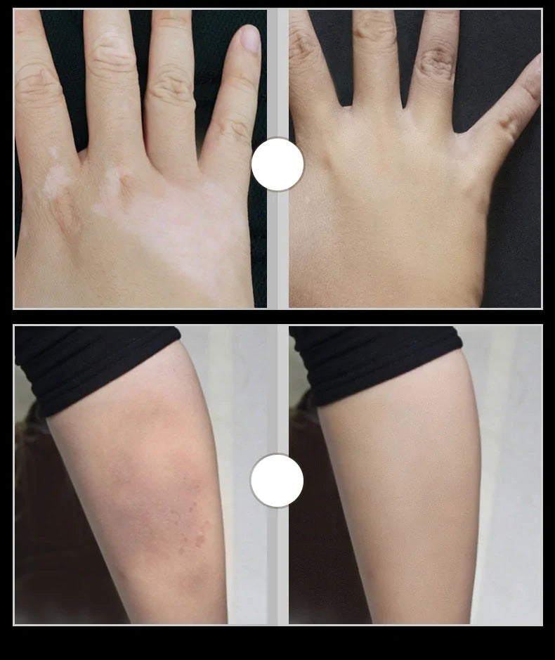 Two-Color Waterproof Body Concealer