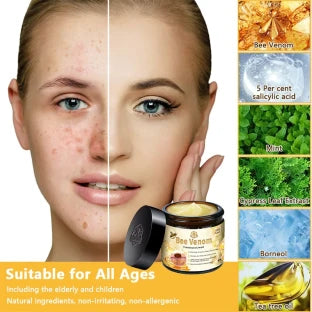 Bee Venom Herbal Cream