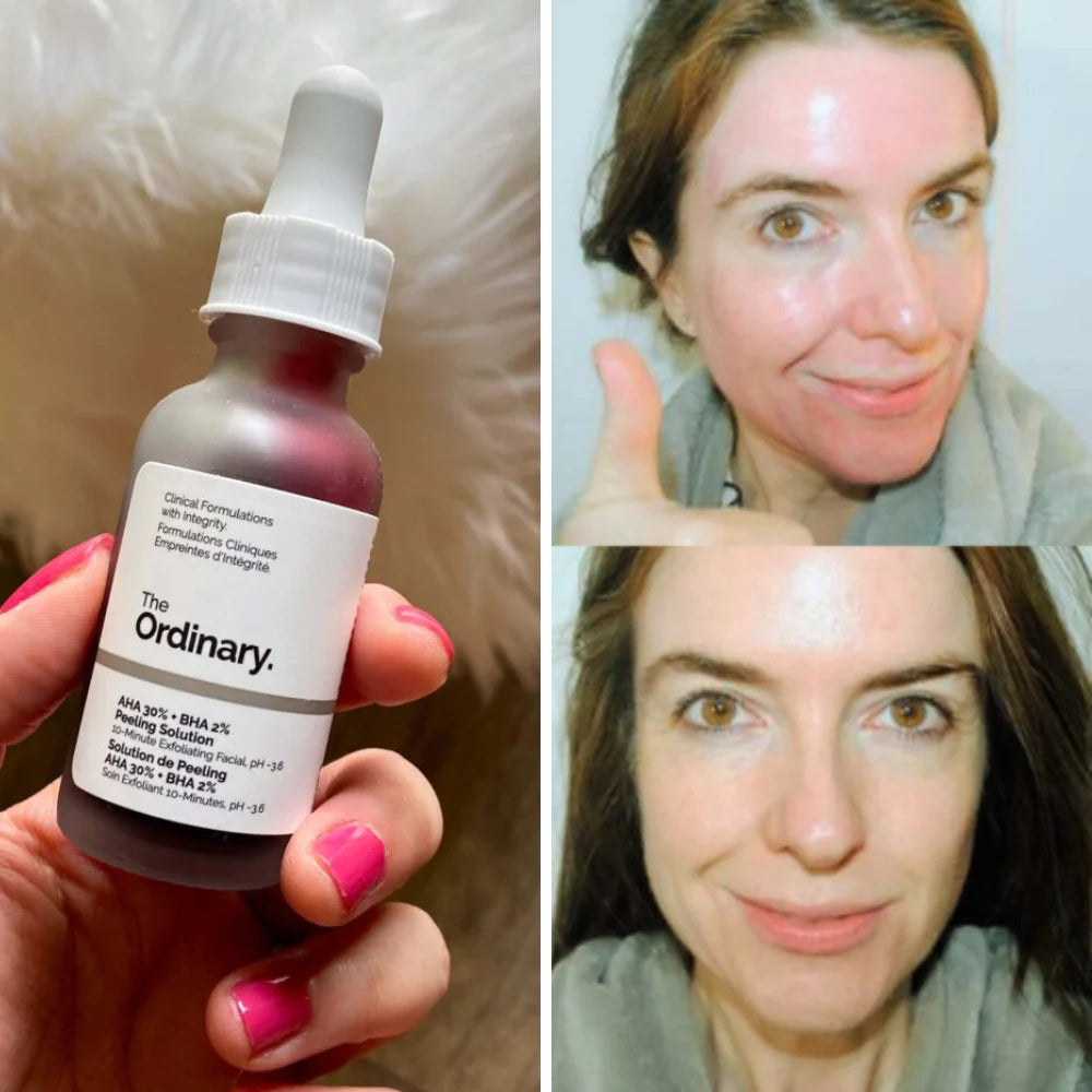 The Ordinary - 30ml AHA 30% + BHA 2% Face Peeling Solution Serum