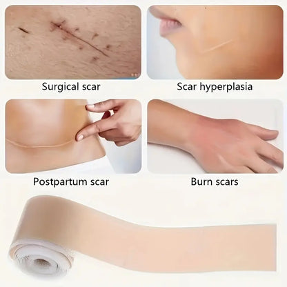 Hons Medical Silicone Scar Sheets