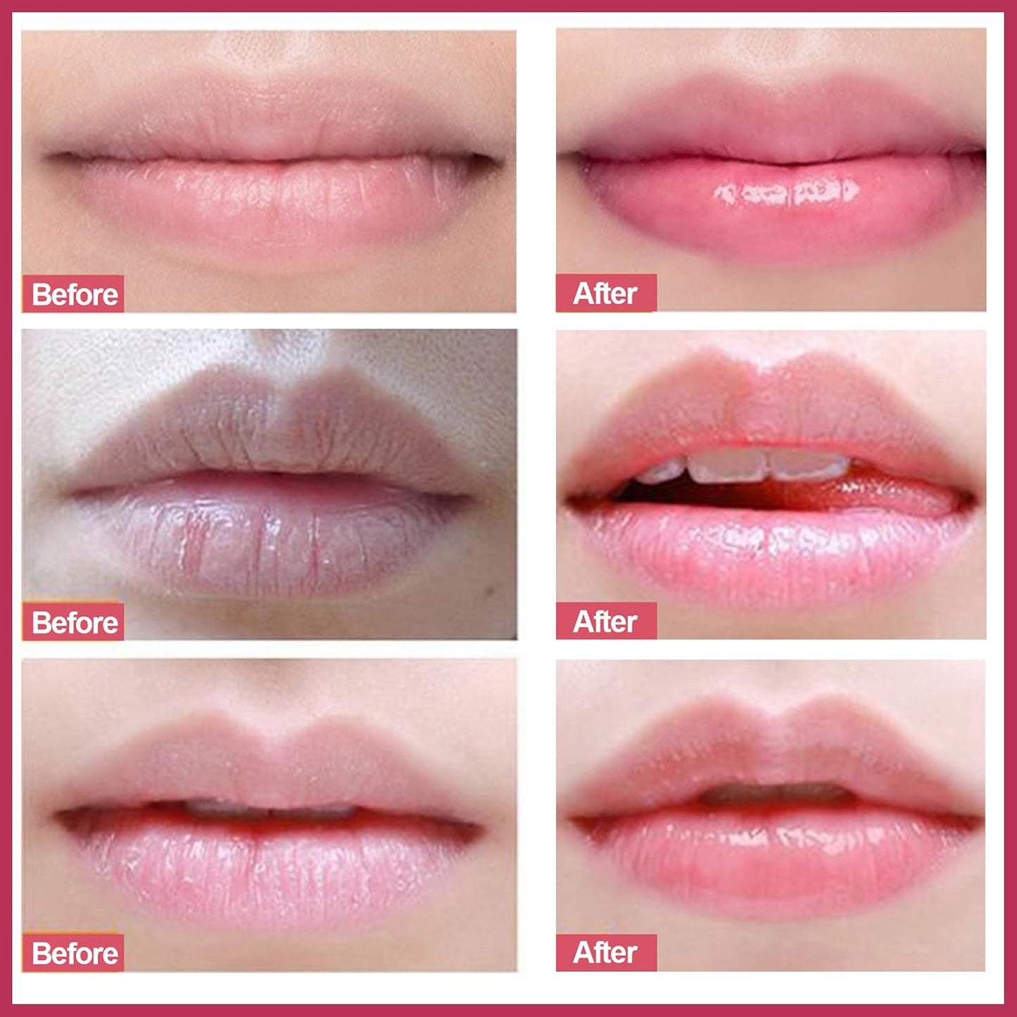 Elaimei Lip Scrub for Exfoliation and Anti-Cracking