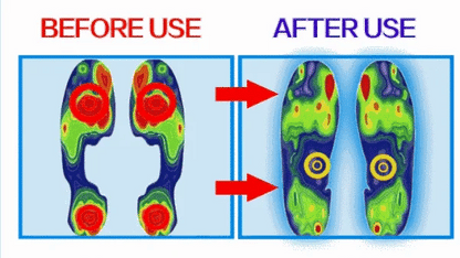 Orthopedic Mesh Sandals