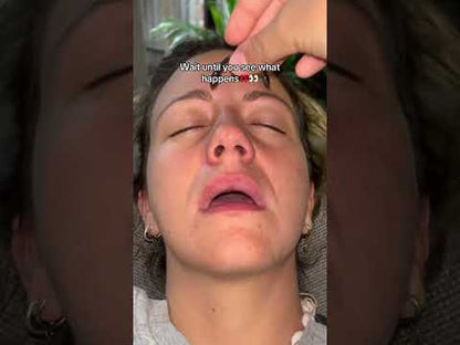 Anti-Snoring Sleep Aid Magnetic Nasal Dilators